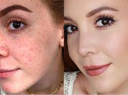 Fondöten Nasıl Sürülür